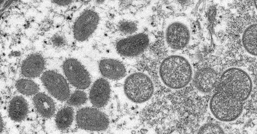 Smallpox of monkeys, the first case in Italy.  How it is transmitted and with what symptoms