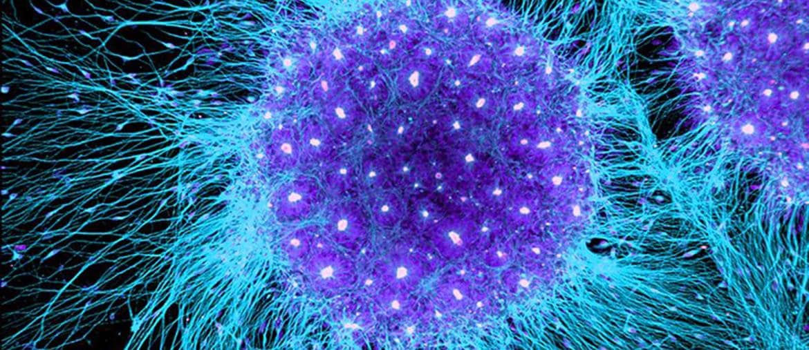 Le  cellule staminali embrionali  umane unite  in sfere  in coltura 