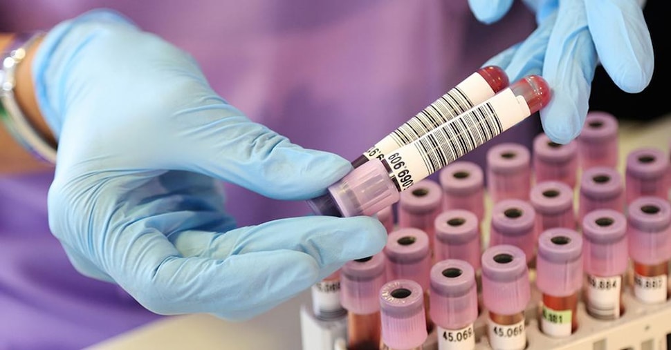 Sifilide in crescita in Europa: più casi tra i giovani e meno prevenzione Sifilide in crescita in Europa: più casi tra i giovani e meno prevenzione