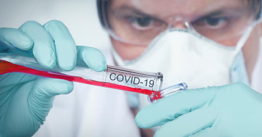 Cura Anti Covid L Ultimo Farmaco Viene Dal Giappone L Aifa Pronta Al Test In Italia Il Sole 24 Ore