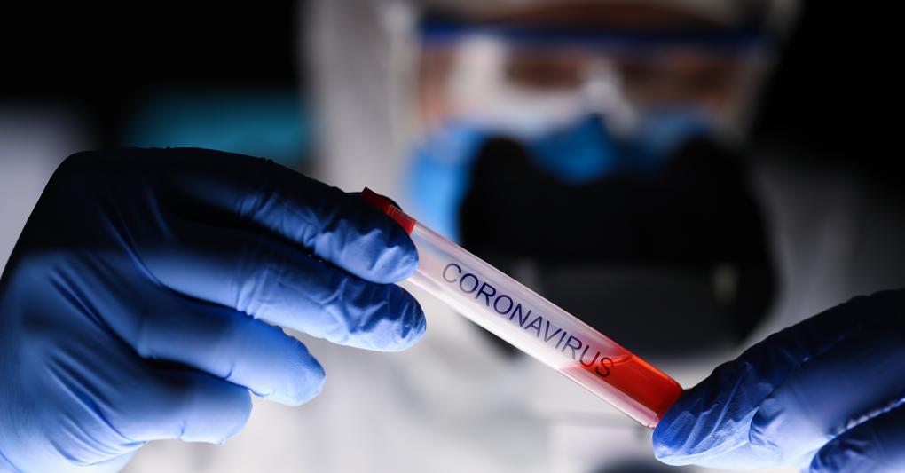 Esami Rapidi Del Sangue Per Tornare Al Lavoro Il Governo Studia La Fase 2 Le Aziende Ci Pensano Il Sole 24 Ore