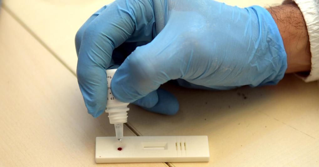 Corsa Ai Test Sierologici Ma Conviene Farli Ecco I Pro E I