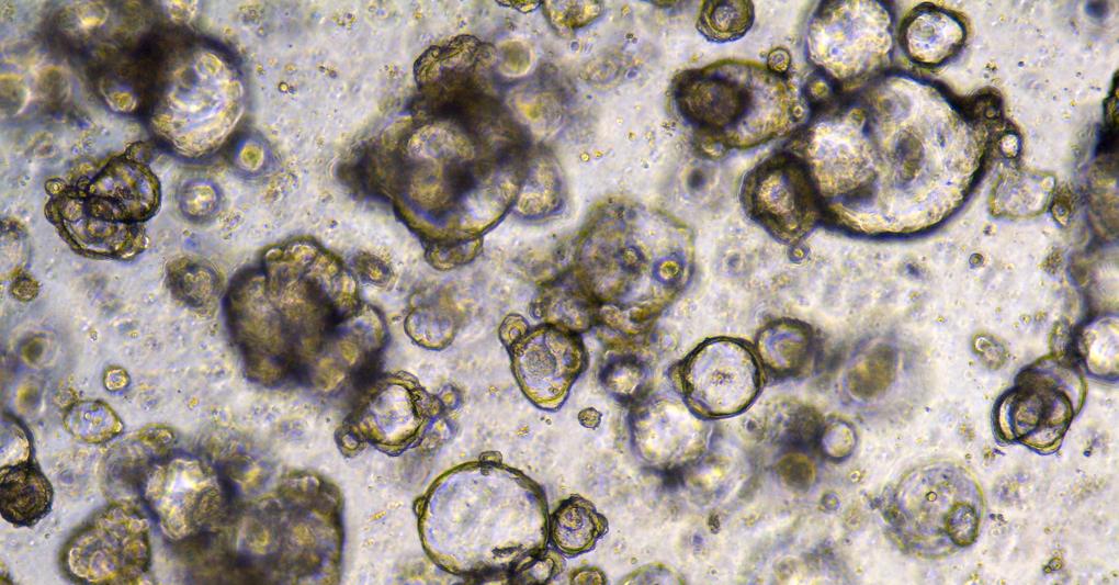 Immagine di organoidi di tumori (Credits: Wellcome Sanger Institute) 