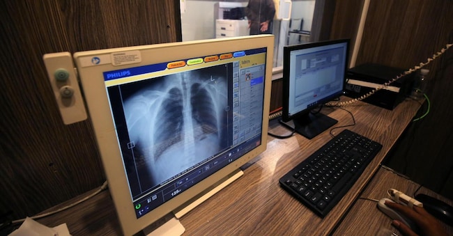 A patient has a radiograph taken of his chest and digitally displayed on a screen at the Lady Reading government hospital, a day ahead of 'World Radiography Day', in Peshawar, Pakistan, 07 November 2023. ANSA/BILAWAL ARBAB 33653 EPA