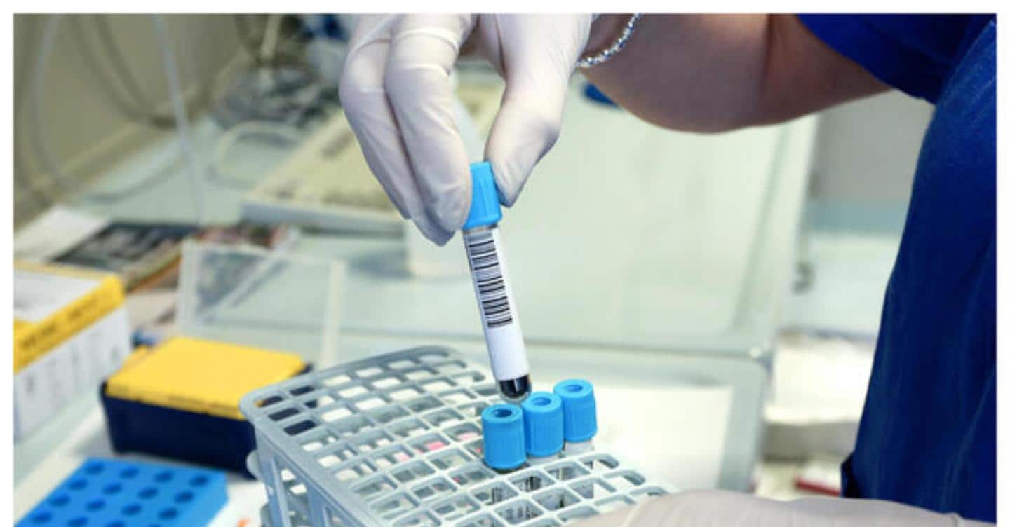 Spegnere la proteina infiammatoria IL-11 aumenta la longevità: scoperta in uno studio su Nature
