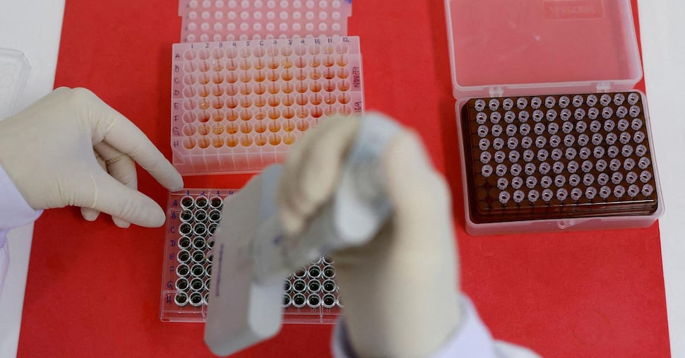 Influenza, primo caso di australiana in Italia. Cosa sappiamo finora