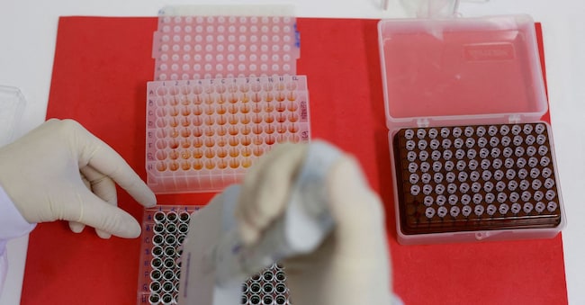 FILE PHOTO: An employee dilutes poultry serum samples for ELISA test for the detection of antibodies to the avian influenza virus at the Reference Laboratory of the World Organization for Animal Health in Campinas, Brazil April 25, 2023. REUTERS/Amanda Perobelli/File Photo