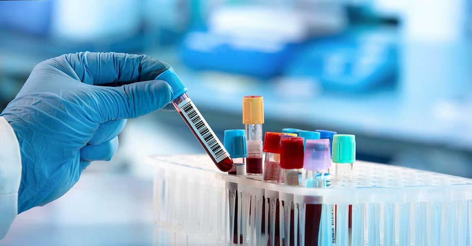 No al sangue dei vaccinati contro il Covid? L’ospedale decide per l’intervento al posto dei genitori No al sangue dei vaccinati contro il Covid? L’ospedale decide per l’intervento al posto dei genitori