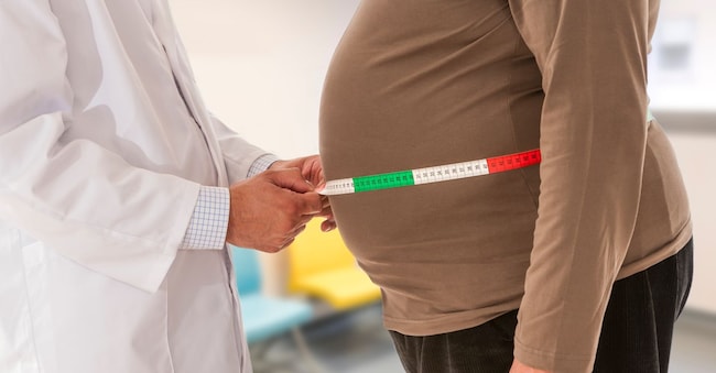 Doctor measuring obese man waist body fat. Obesity and weight to loose. JPC-PROD - stock.adobe.com