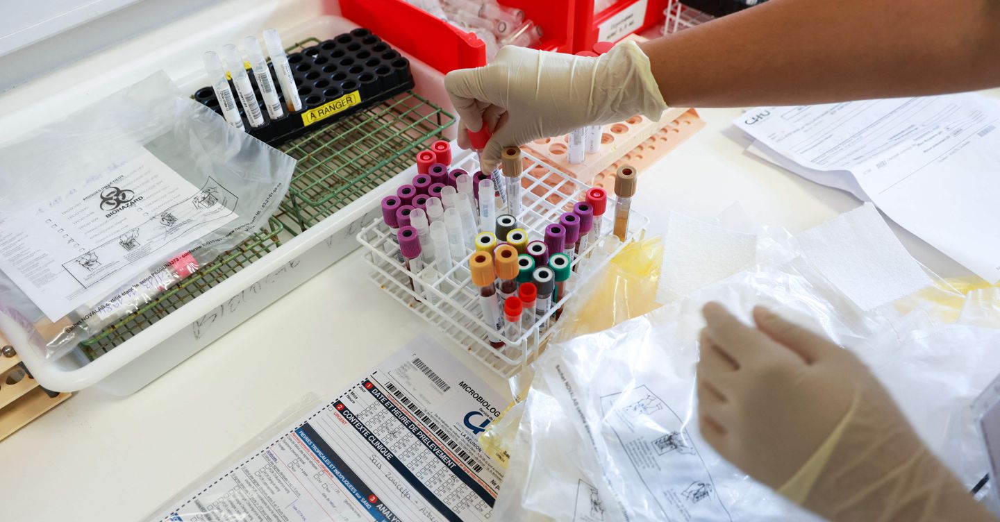 Spesa sanitaria: dimenticati gli investimenti per la prevenzione