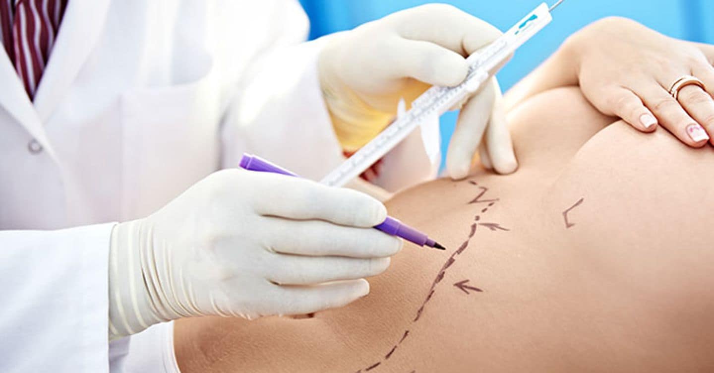 “Voglio fare un intervento di mastoplastica, ma come faccio a scegliere il chirurgo plastico?”