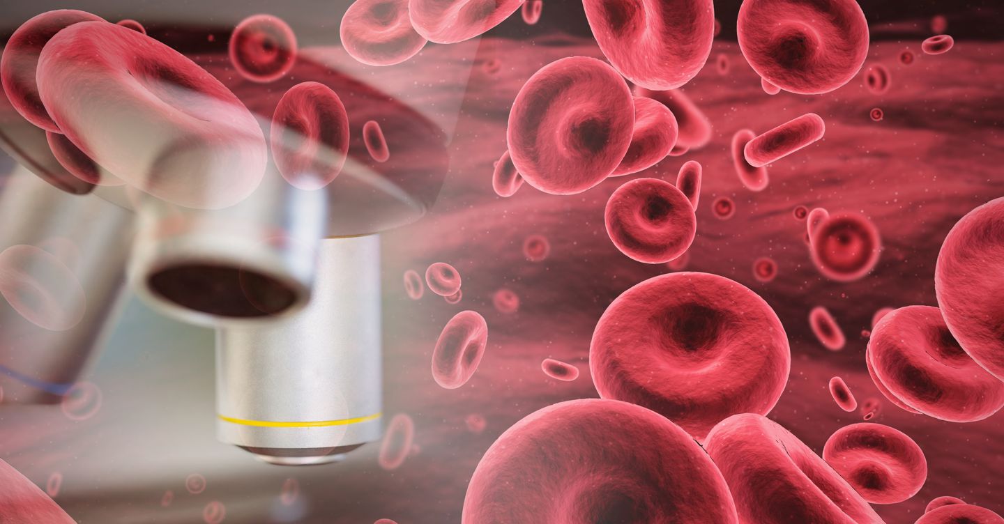 Terapie Car-t, eccellenza a metà con troppe disuguaglianze