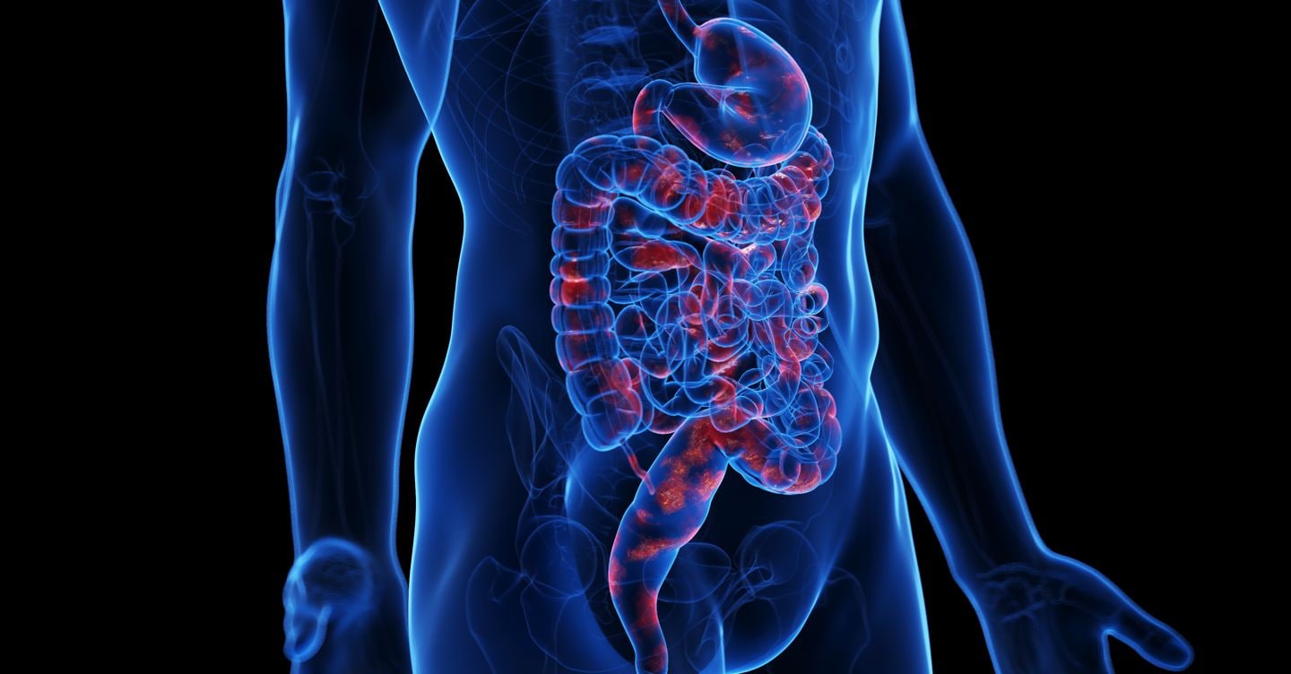 Oncologia e sostenibilità: così l’investimento  sull’attività fisica contrasta il tumore del colon