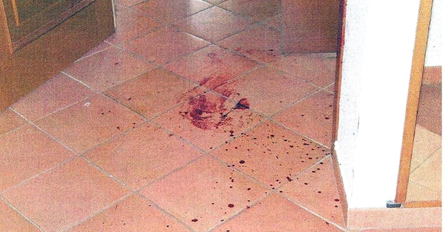  Immagine allegata alla consulenza di parte civile nel processo Stasi. Ansa/Immagine allegata alla consulenza di parte civile/Drn