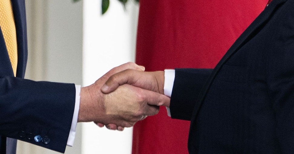 Dalle caviglie gonfie ai lividi sulle mani: ecco cos’è l’insufficienza venosa e perché Trump ne soffre Dalle caviglie gonfie ai lividi sulle mani: ecco cos’è l’insufficienza venosa e perché Trump ne soffre
