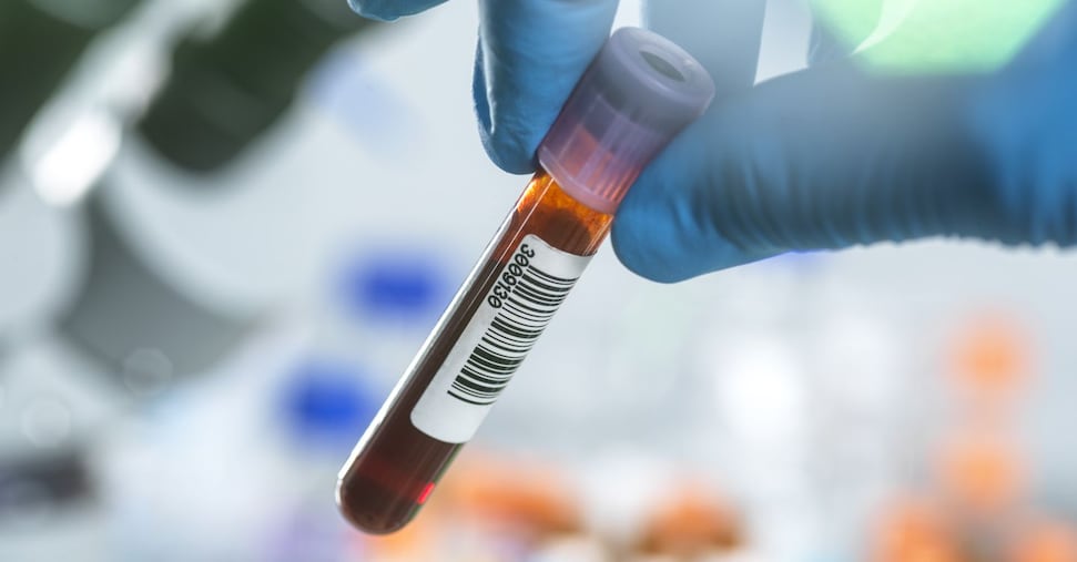 Hiv, via libera dell’Ema alla profilassi che si fa due volte l’anno