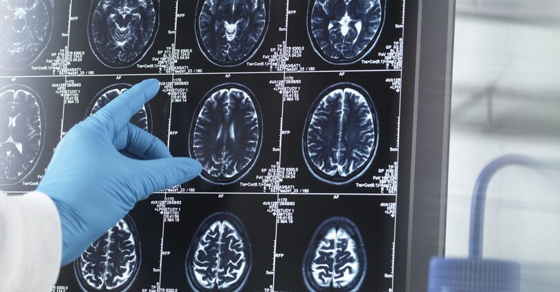 (Tek Image/Science Photo Library / AGF)