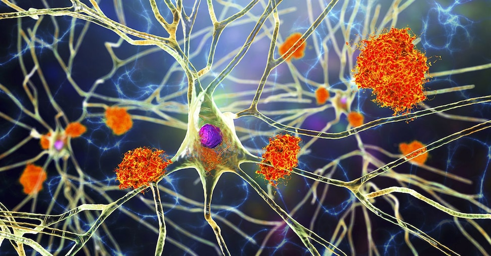 Riparare la barriera del cervello: così i ricercatori hanno invertito l’Alzheimer nei topi