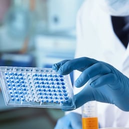 Researcher working with microplate panel for diseases diagnosis in the laboratory. Doctor working with microplate for elisa analysis