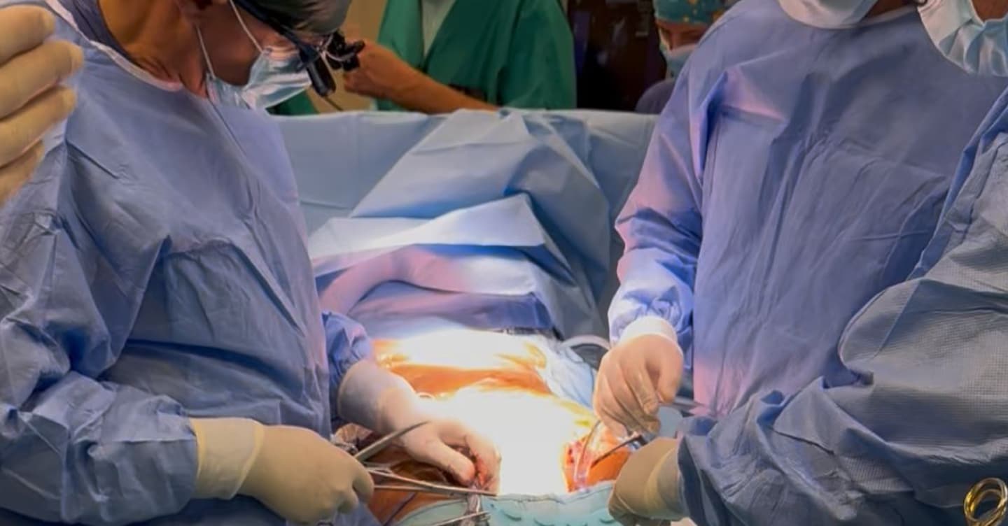 Napoli, realizzato al II Policlinico il primo trapianto multiorgano a cuore fermo
