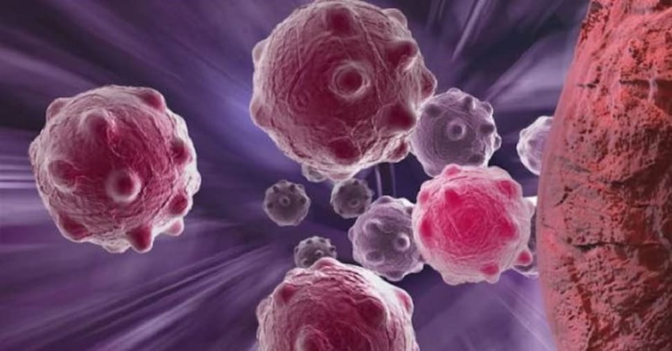 Cancro dell’endometrio avanzato: una nuova terapia aumenta la sopravvivenza