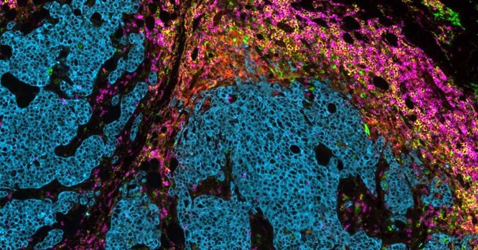 Il GPS delle cellule tumorali nel nuovo centro  di eccellenza del Pascale a Mercogliano