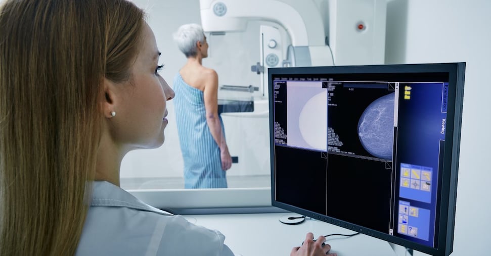 Tumore al seno, oltre 9 protesi su dieci inserite subito dopo la mastectomia