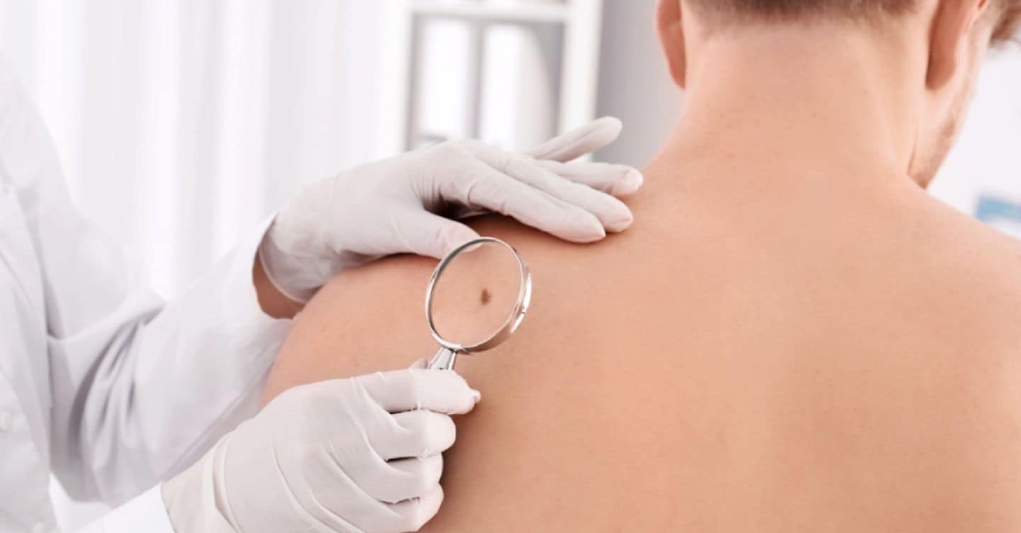 https://i2.res.24o.it/images2010/S24/Documenti/2026/05/05/Immagini/Ritagli/Prevenzione%20melanoma%201020x533-U58025612637Pek-1440x752@IlSole24Ore-Web.jpg