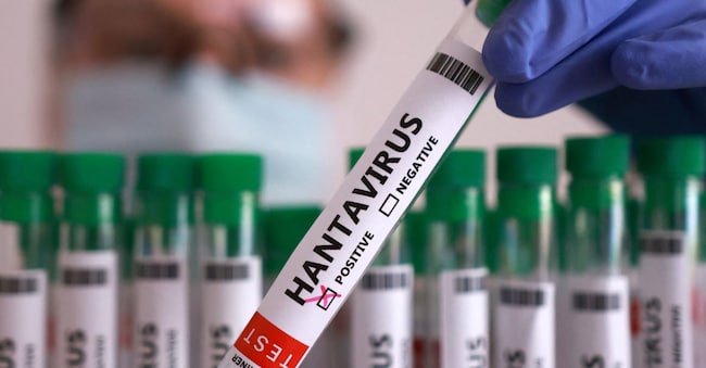 A test tube labelled "Hantavirus positive" is held in this illustration taken May 7, 2026. REUTERS/Dado Ruvic/Illustration REUTERS