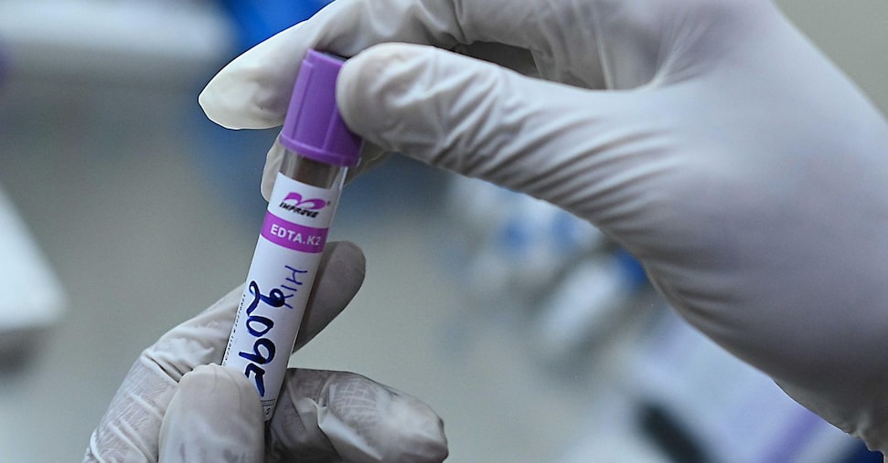 Malattia e longevità: un test del sangue svela la nostra età biologica Malattia e longevità: un test del sangue svela la nostra età biologica