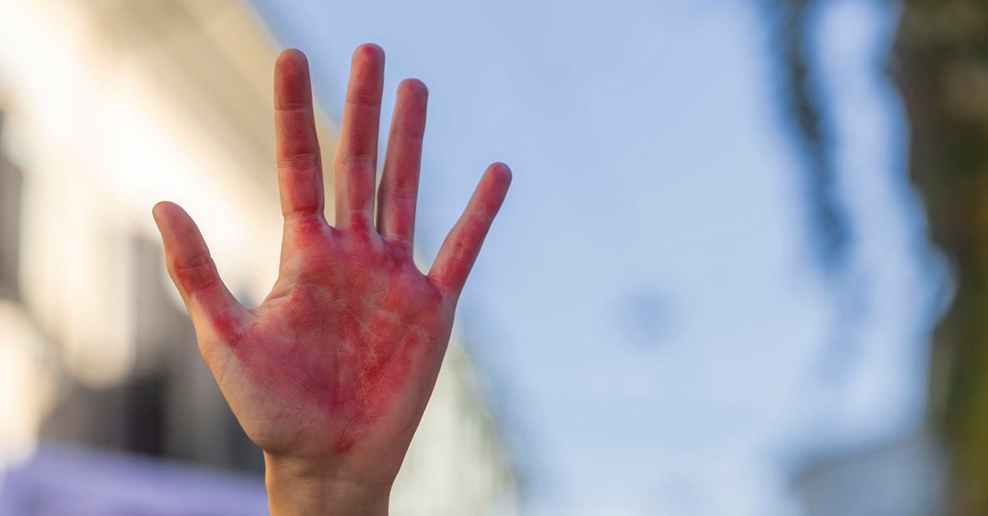 Violenza sessuale, stop alla pubblicazione di dettagli che sollecitano la morbosità