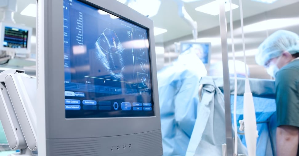 Liste d’attesa in sanità, a due anni dalla legge solo due Regioni adempienti sui tempi massimi Liste d’attesa in sanità, a due anni dalla legge solo due Regioni adempienti sui tempi massimi