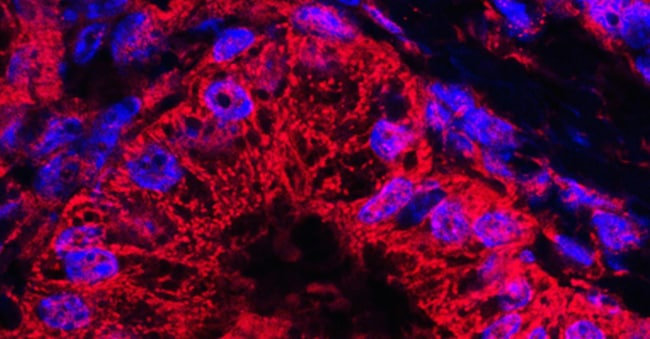 Immagine microscopica di cellule tumorali pancreatiche con mitocondri colorati. (Alamy Stock Photo)