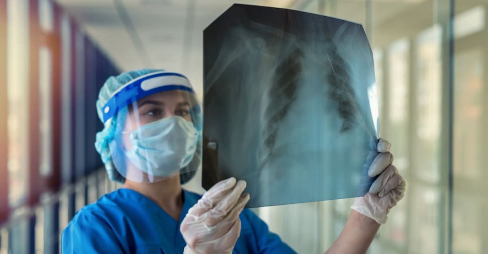 Infezioni, 250mila casi di sepsi l’anno  ma in Italia cure disuguali tra Nord e Sud