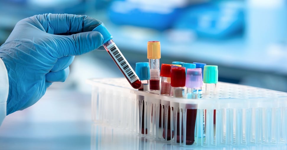 Droni per i trasporti urgenti di farmaci e provette: il test dell’ospedale Niguarda