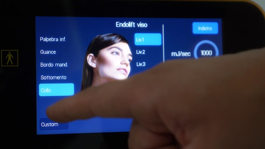 Display touch del sistema laser Endolift, utilizzato per selezionare e impostare le diverse aree di trattamento del viso, tra cui palpebra inferiore, guance, bordo mandibolare, sottomento e collo.