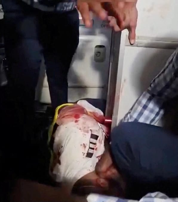CONTENUTO SENSIBILE. QUESTA IMMAGINE POTREBBE RISULTARE OFFENSIVA O DISTURBANTE - I passeggeri si radunano attorno a un uomo ferito a bordo di un aereo della flydubai diretto a Tel Aviv, costretto ad atterrare in Arabia Saudita dopo che, secondo quanto riferito, i piloti avrebbero litigato nella cabina di pilotaggio. (SOCIAL MEDIA via REUTERS)
