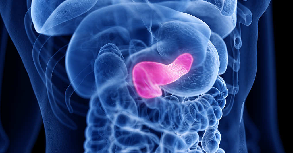 Tumore al pancreas e adenocarcinoma polmonare: novità dalla ricerca