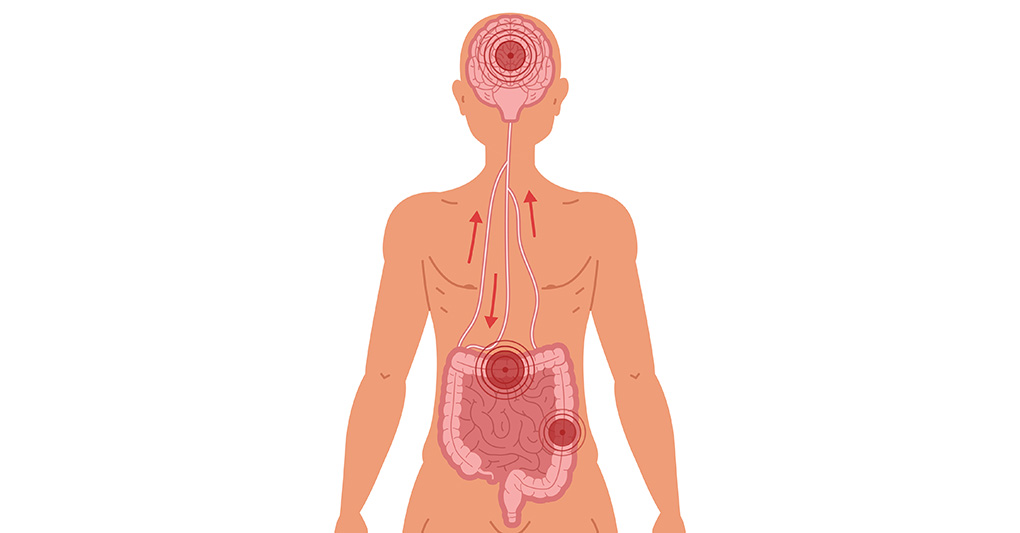 Asse intestino cervello: il ruolo del microbiota