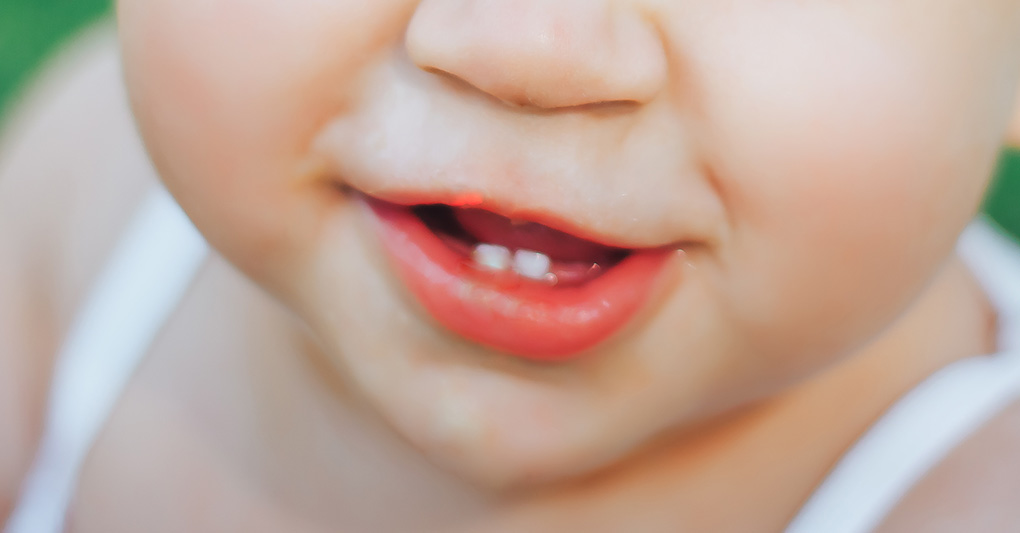 Dai denti da latte ai denti permanenti dei bambini