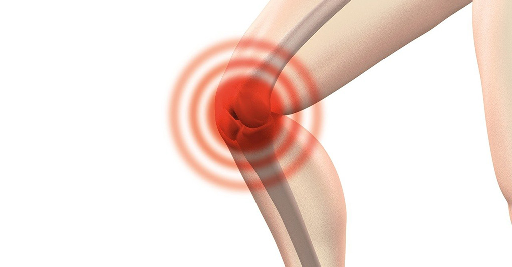 Cartilagine del ginocchio: cosa fare se è consumata