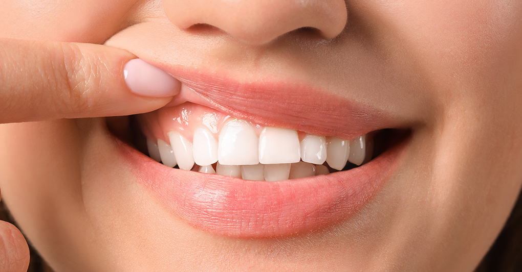 Denti e gengive: dalla prevenzione alla cura