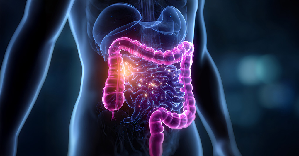 Cancro al colon: microbioma come sensore precoce di salute