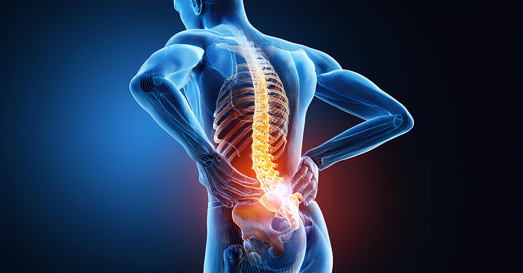 Colpo della strega: cause, prevenzione e rimedi 