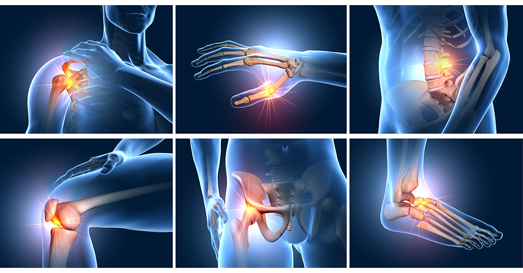 Malattie reumatologiche: rigidità, dolore e novità terapeutiche 