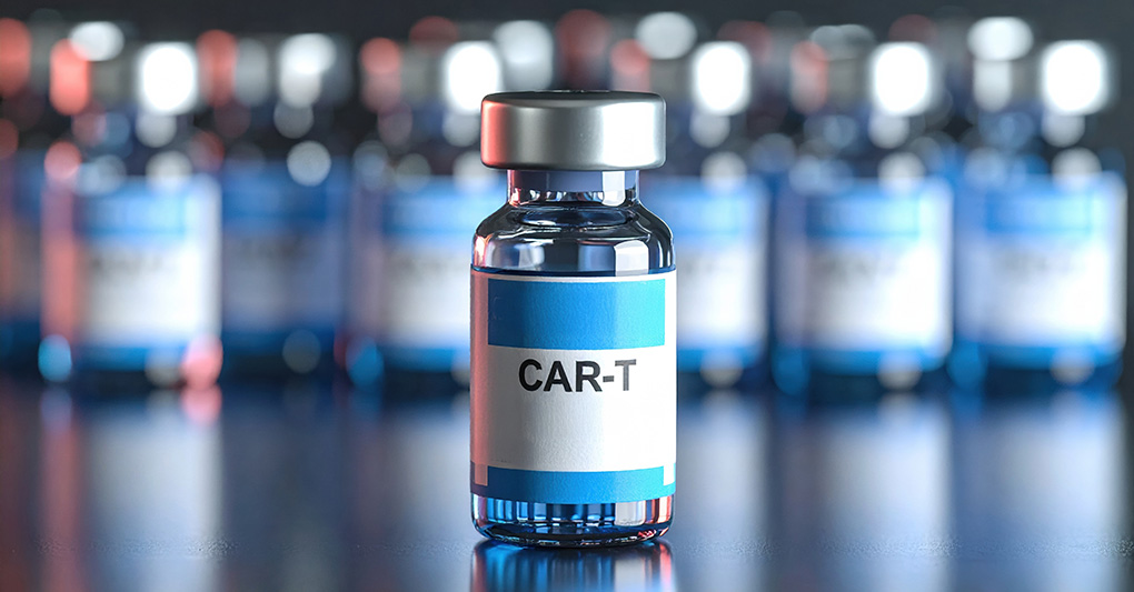 L'efficacia delle cellule CAR-T nelle malattie autoimmuni dell'età pediatrica