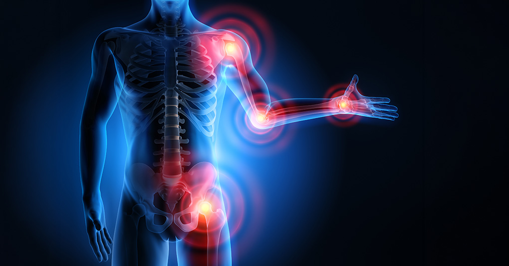 Artrosi: i gesti quotidiani che misurano la qualità della vita Artrosi: i gesti quotidiani che misurano la qualità della vita