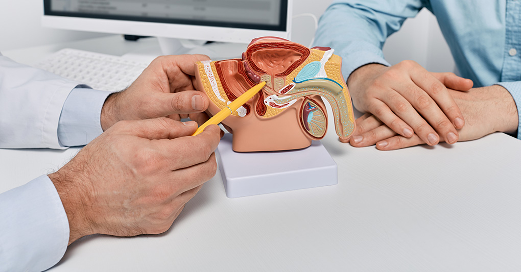 Intervento alla prostata: continenza, funzione e qualità della vita