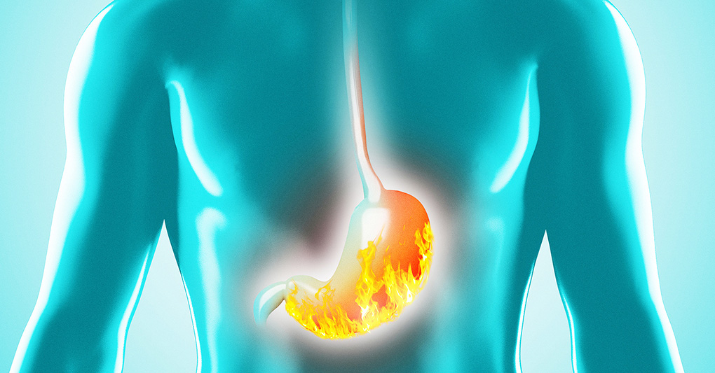 Reflusso: perché con il cambio di stagione può peggiorare?