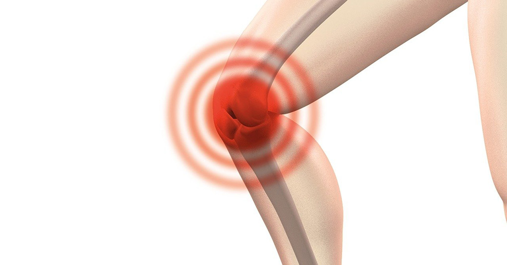 Fastidio al ginocchio al mattino? Ecco cosa ci sta dicendo